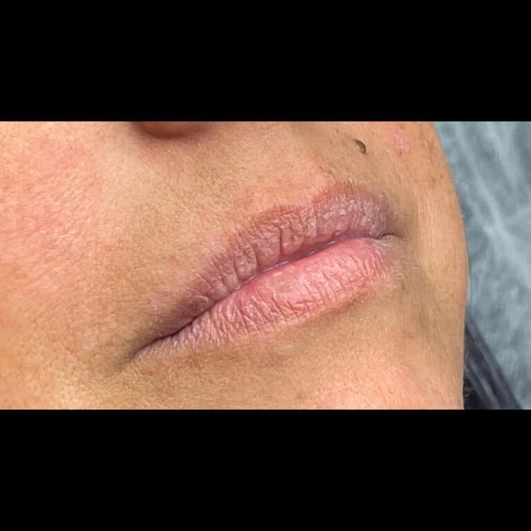 Before Image: Lip Blushing - right-front-oblique